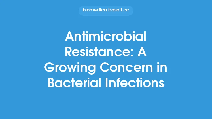 Antimicrobial Resistance: A Growing Concern in Bacterial Infections Thumbnail