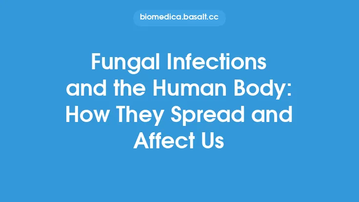 Fungal Infections and the Human Body: How They Spread and Affect Us Thumbnail