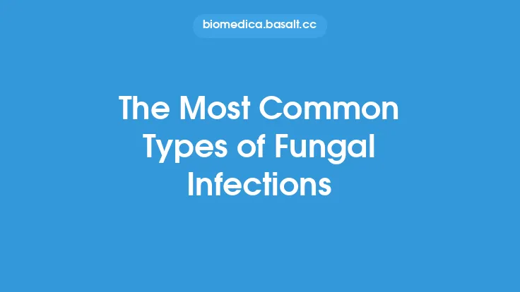 The Most Common Types of Fungal Infections Thumbnail